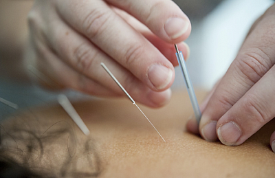 Zhen Acupuncture Healing Center - Newport Beach | Doctors & Clinics | Logo